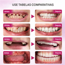 LOVILDS Cola para Próteses FirmHold — Até 15 Dias de Fixação Sem Escorregar (Somente HOJE!)🔥