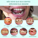 ⏰Prótese Dentária Premium Tiworld® 🍀Próteses Funcionais AdaptableFit (Somente HOJE!)🔥