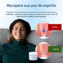 𝗖𝘃𝗿𝗲𝗼𝘇® 𝗖𝗿𝗲𝗺𝗲 𝗽𝗮𝗿𝗮 𝗛𝗲𝗺𝗼𝗿𝗿𝗼𝗶𝗱𝗮𝘀 𝗲 𝗙𝗶𝘀𝘀𝘂𝗿𝗮𝘀 (Somente HOJE!)🔥