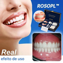 ROLOPL™ Conjunto de prótese total personalizada avançada🦷 (Somente HOJE!)🔥