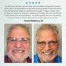 Próteses dentárias ROSOPL™ personalizadas e totalmente funcionais para um sorriso mais confiante! (Somente HOJE!)🔥